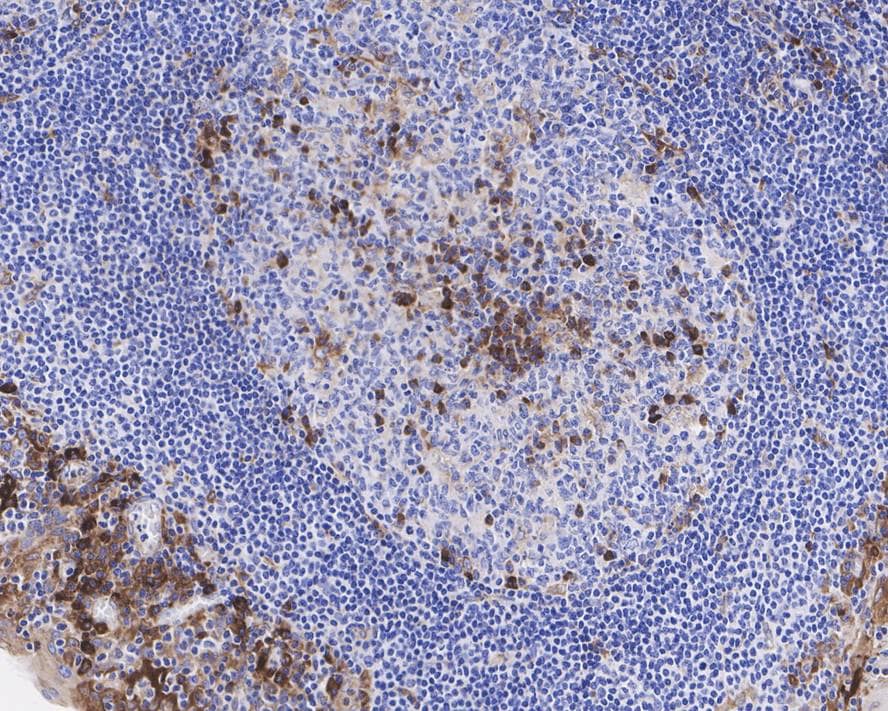 VIPR1/VPAC1 Antibody (PD00-96)