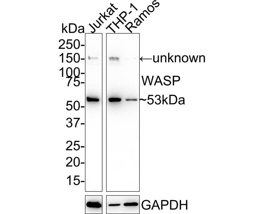 WASP Antibody (JE36-82)