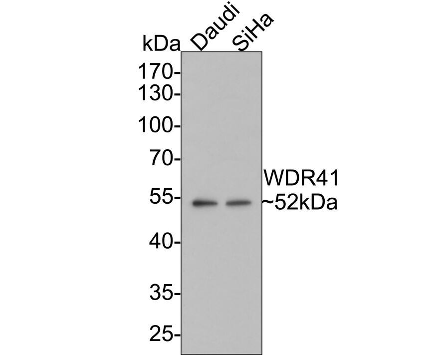 WDR41 Antibody (A9C10)