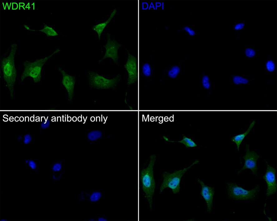 WDR41 Antibody (A9C10)