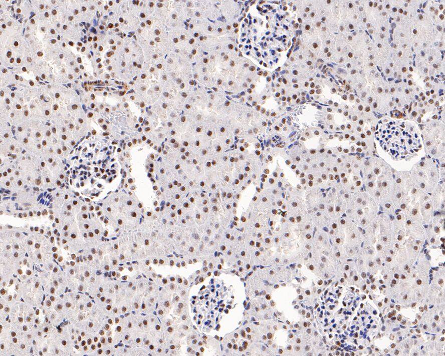 WDR41 Antibody (A9C10)