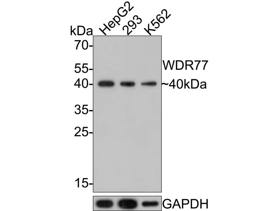 WDR77 Antibody (PSH0-07)