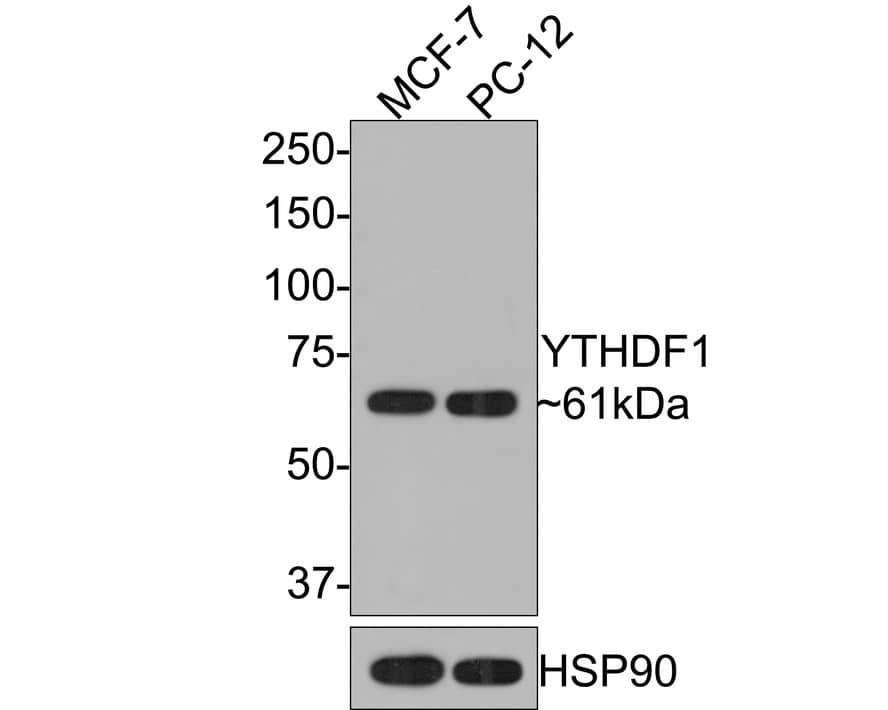 YTHD1 Antibody