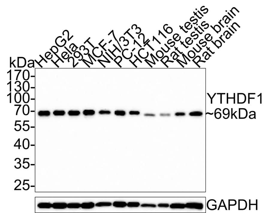 YTHD1 Antibody (PSH0-23)