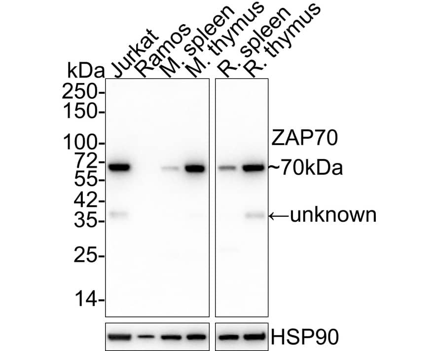 ZAP70 Antibody (A1B5-R)