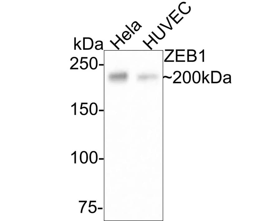 ZEB1 Antibody (JE57-64)