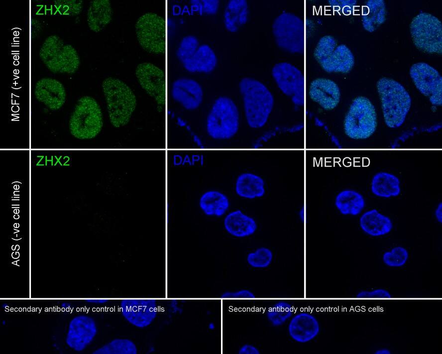 ZHX2 Antibody (JE63-11)