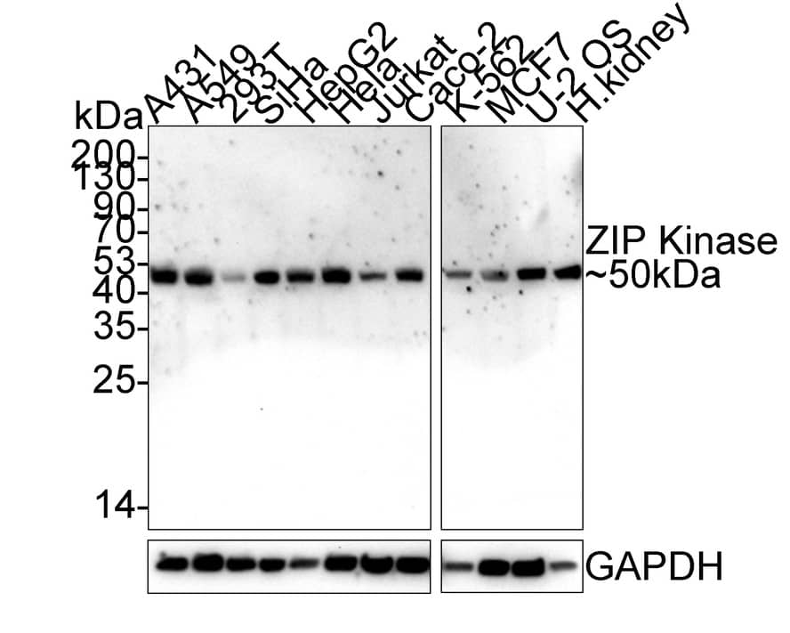 DAPK3/ZIPK Antibody (PSH02-18)