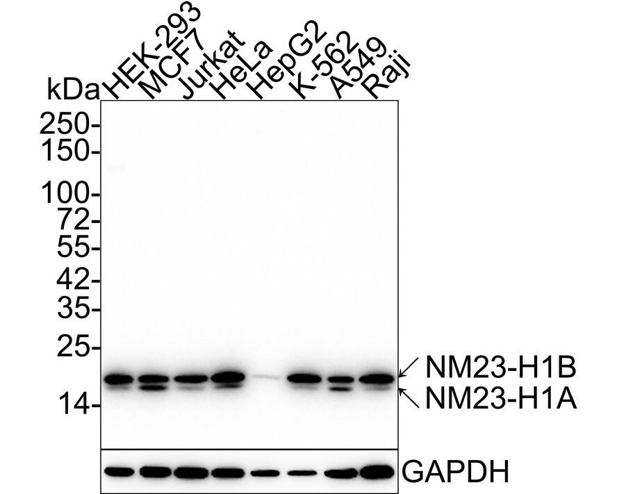 NM23-H1 Antibody (13C1-R)