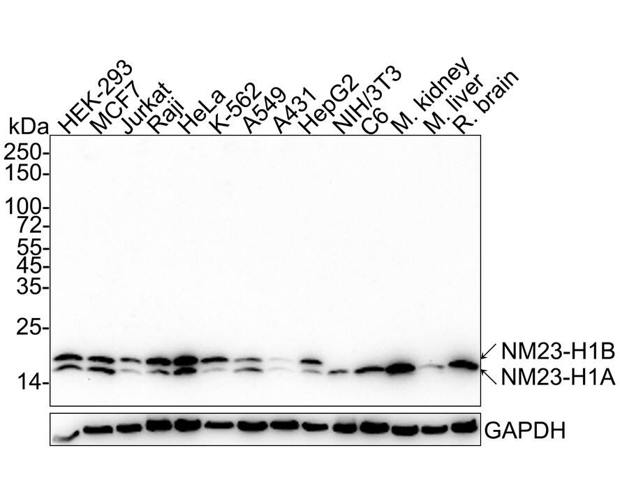 NM23-H1 Antibody (13C2-R)