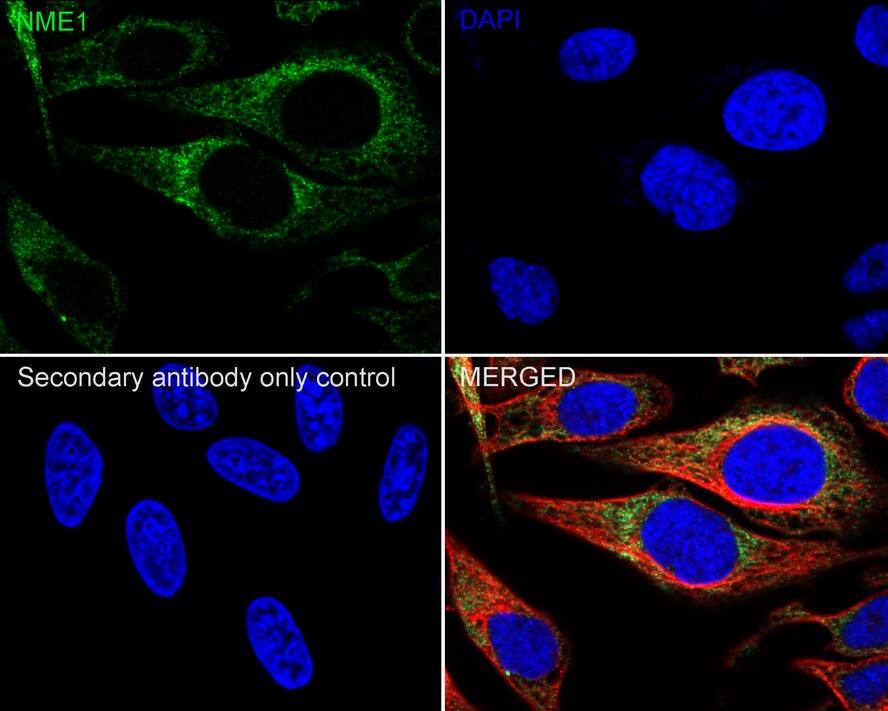 NM23-H1 Antibody (13C2-R)