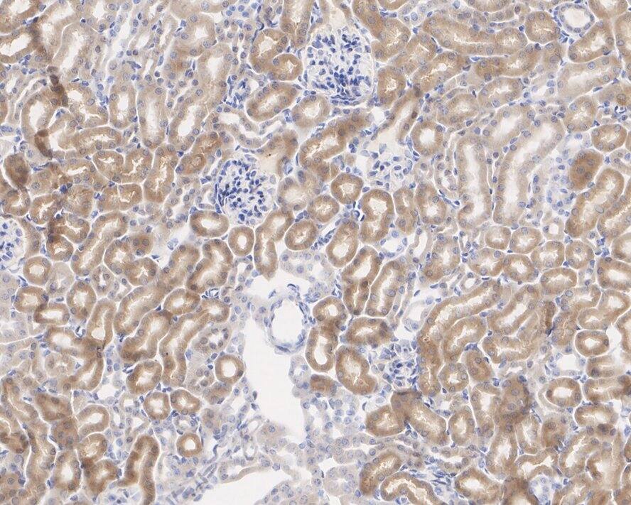 NM23-H1 Antibody (13C2-R)