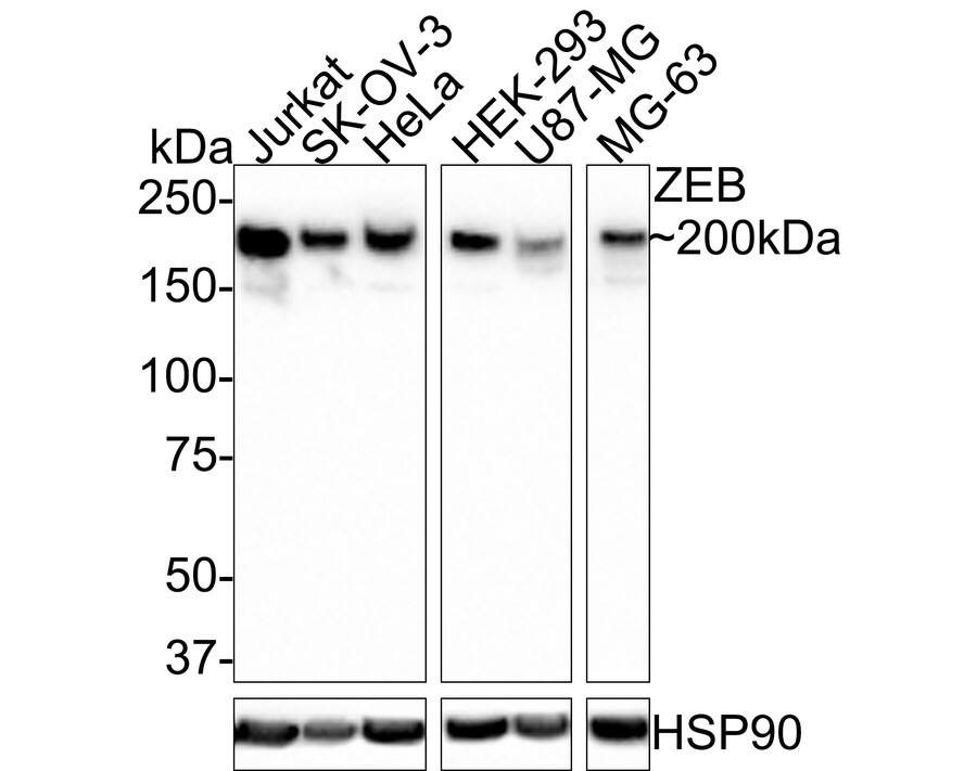 ZEB1 Antibody (PSH0-61)