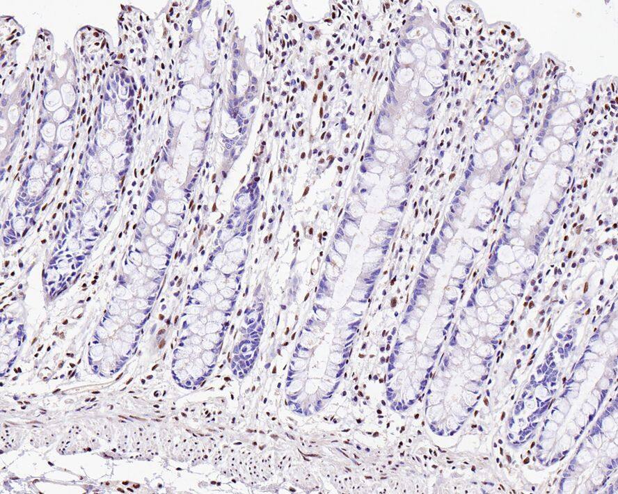 ZEB1 Antibody (PSH0-61)