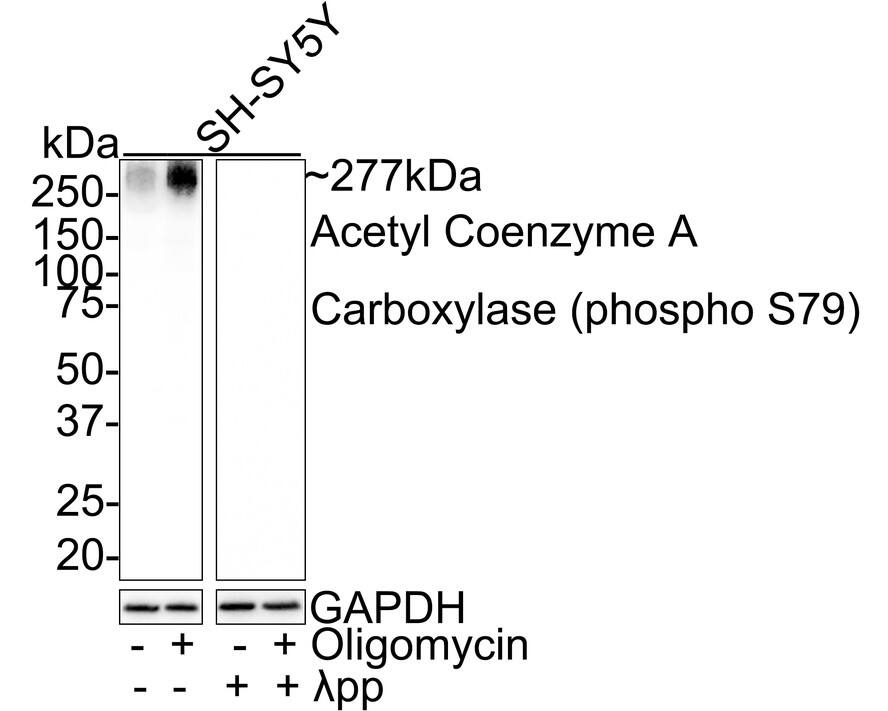 Acetyl-CoA Carboxylase alpha/ACACA [p Ser79] Antibody (JE55-54)