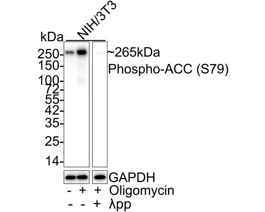 Acetyl-CoA Carboxylase alpha/ACACA [p Ser79] Antibody (JE63-95)