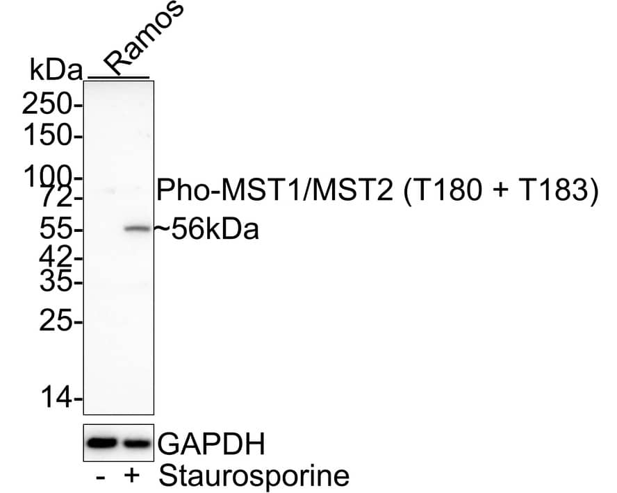 MST1/2 [p Thr180, p Thr183] Antibody (JE46-64) Western Blot: MST1/2 [p Thr180, p Thr183] Antibody (JE46-64) [NBP3-33136]