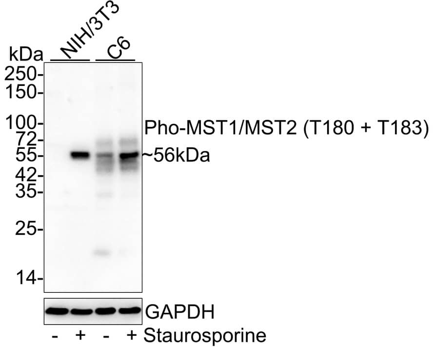 MST1/2 [p Thr180, p Thr183] Antibody (JE46-64) Western Blot: MST1/2 [p Thr180, p Thr183] Antibody (JE46-64) [NBP3-33136]