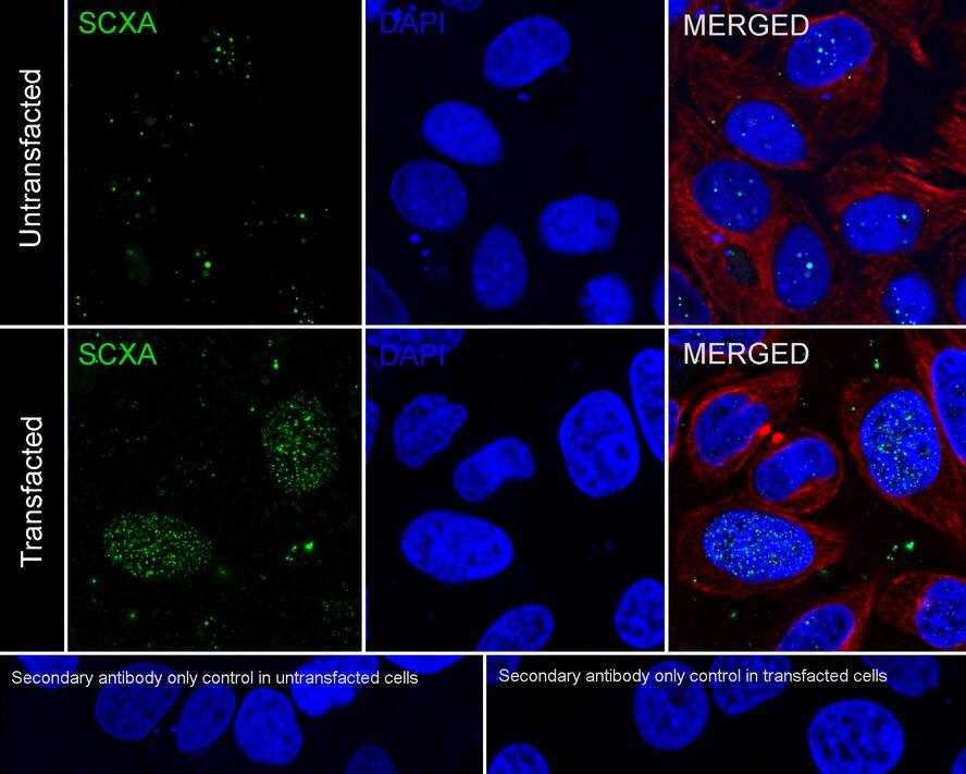 SCX Antibody (PSH02-25)