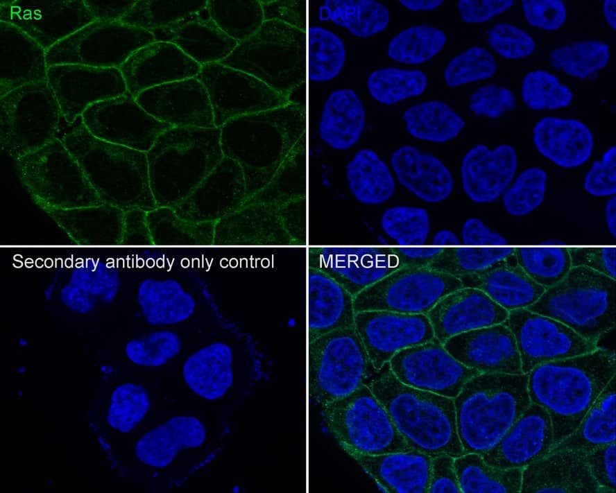 Ras Antibody (JE44-13)