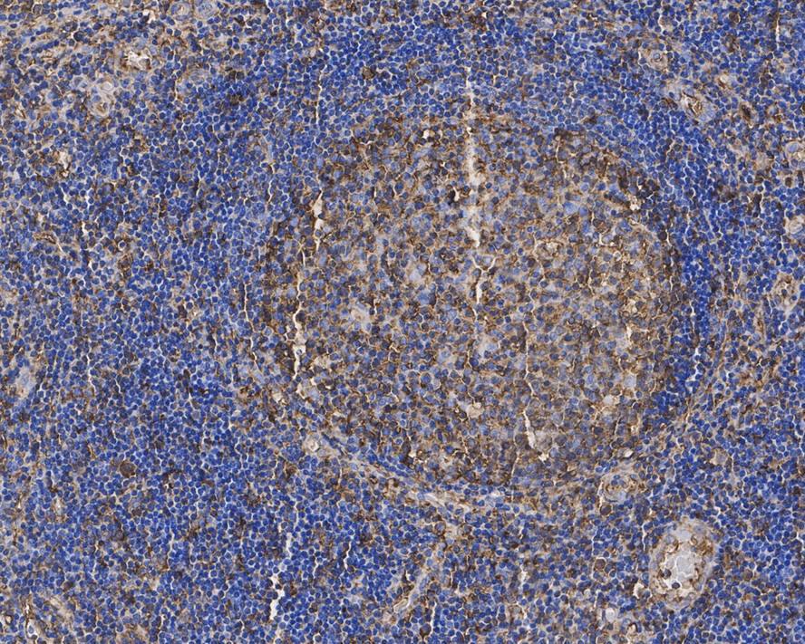 alpha Tubulin Antibody (PSH02-94)