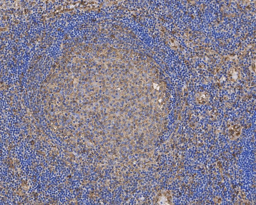 alpha Tubulin Antibody (PSH02-95)