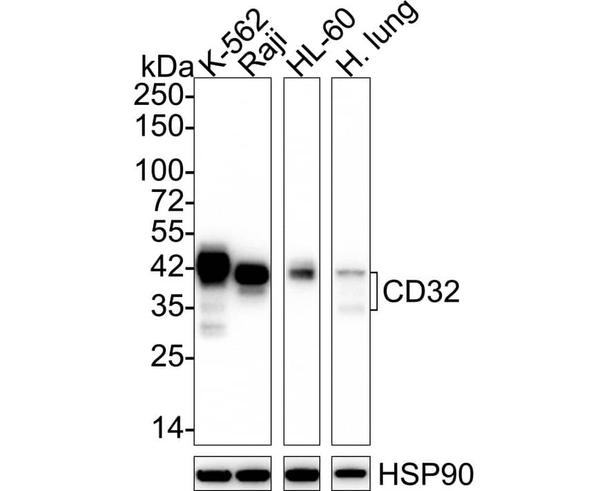 Fc gamma RIIA/CD32a Antibody (JE64-17) Western Blot: Fc gamma RIIA/CD32a Antibody (JE64-17) [NBP3-33141]