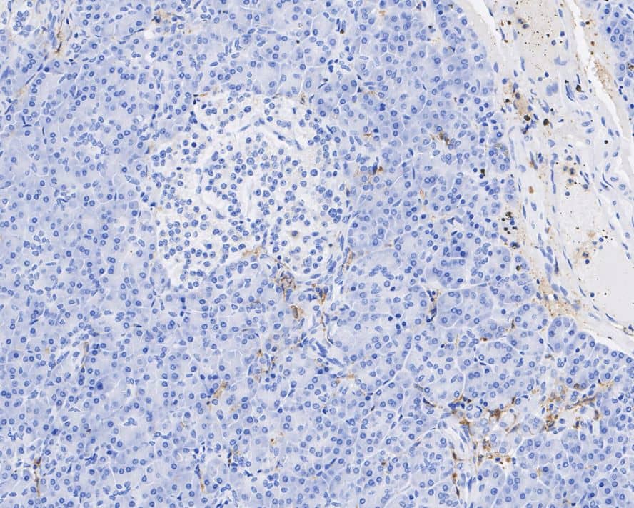 Fc gamma RIIA/CD32a Antibody (JE64-17)