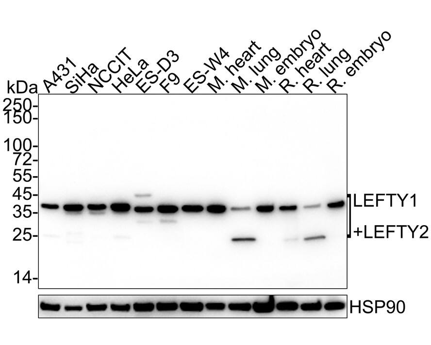 Lefty1/2 Antibody (JE38-88) Western Blot: Lefty1/2 Antibody (JE38-88) [NBP3-33142]