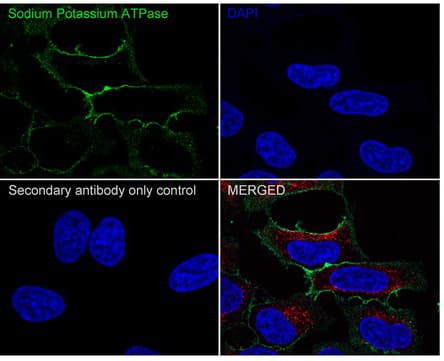 Sodium Potassium ATPase Alpha 1 Antibody (ST0533)