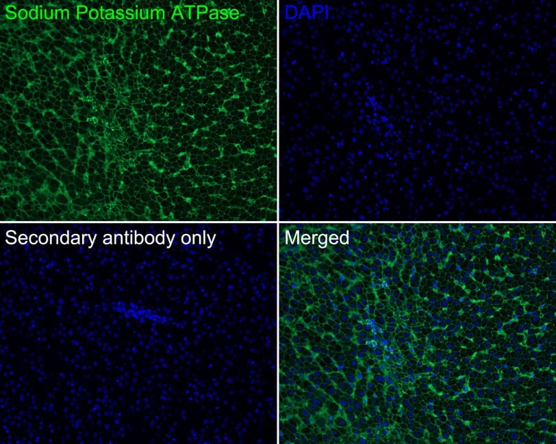 Sodium Potassium ATPase Alpha 1 Antibody (ST0533)