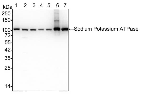 Sodium Potassium ATPase Alpha 1 Antibody (ST0533)