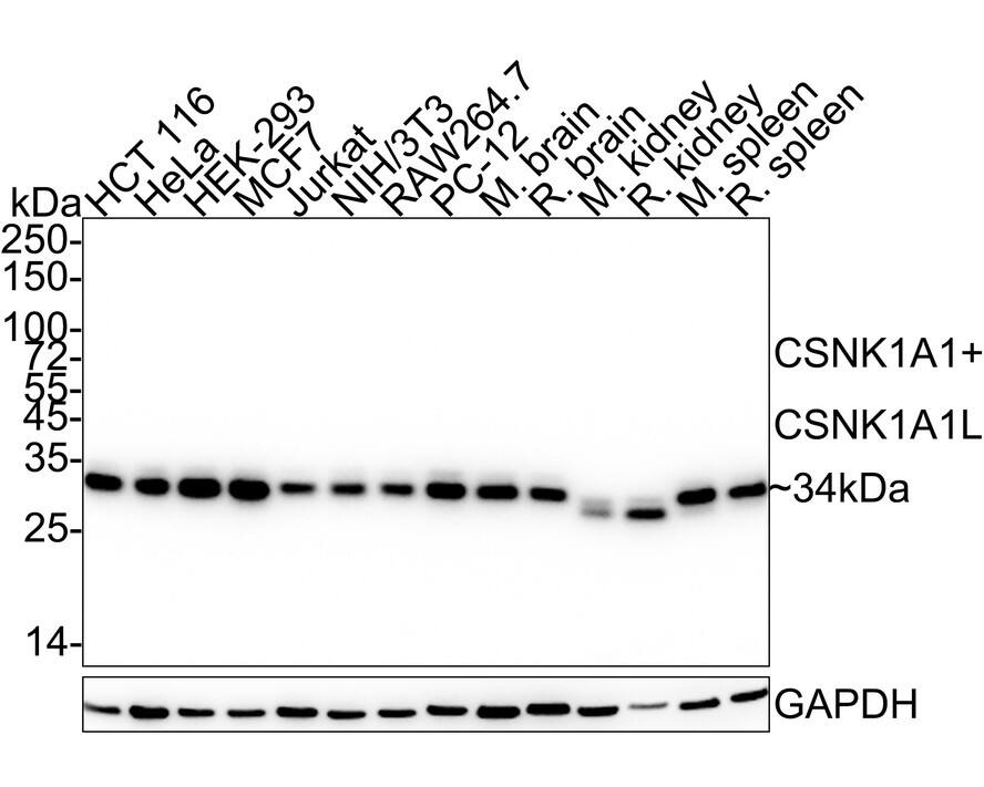 CSNK1A1/CSNK1A1L Antibody (PSH04-58)