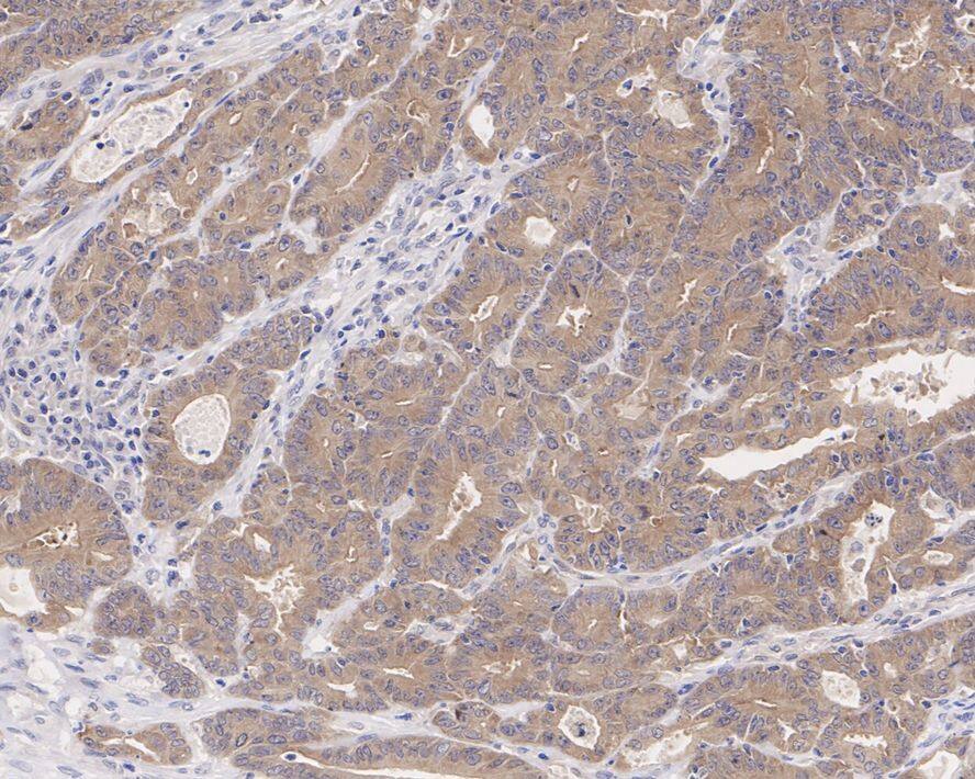CSNK1A1/CSNK1A1L Antibody (PSH04-58)