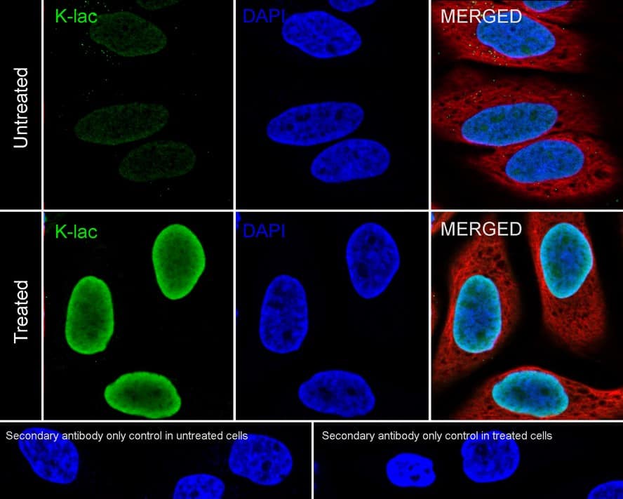 【CPC-LSF】杏 Lactyl-Lysine Antibody (PSH03-73) (NBP3-33149) by Novus, Part of