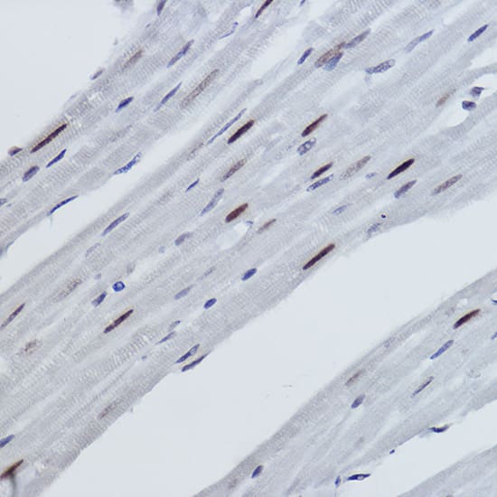 Histone H2B [Monomethyl Lys116] Antibody (3R10S2)
