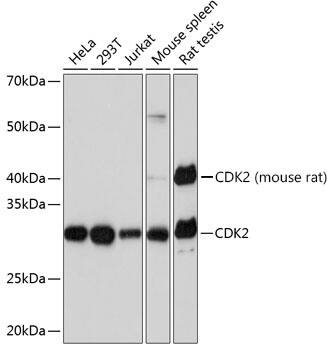 CDK2 Antibody (10E0N5)