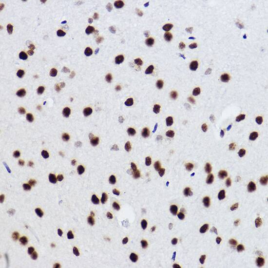 BRMS1 Antibody (5Y8J3)