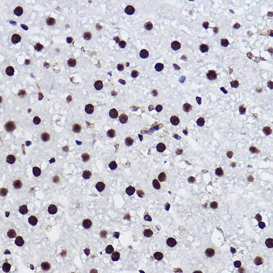 BRMS1 Antibody (5Y8J3)