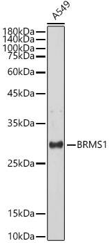 BRMS1 Antibody (5Y8J3)