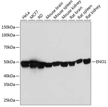 Enolase 1 Antibody (9E5R2)