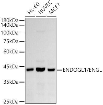 ENDOGL1 Antibody (2W6V1)