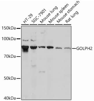 GOLM1 Antibody (2Q4F0)