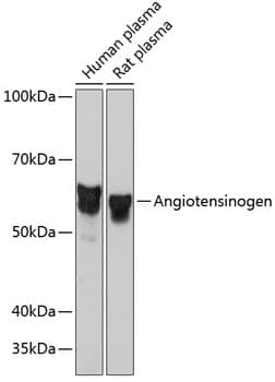 Serpin A8/Angiotensinogen Antibody (9Q5D4)