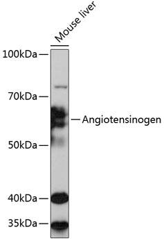 Serpin A8/Angiotensinogen Antibody (9Q5D4)