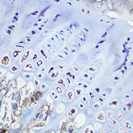 Aggrecan Antibody (6L4T2)