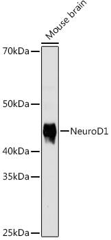 NeuroD1 Antibody (5V4L8)