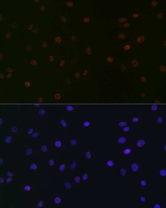 SUPT5H Antibody (9V9G7)