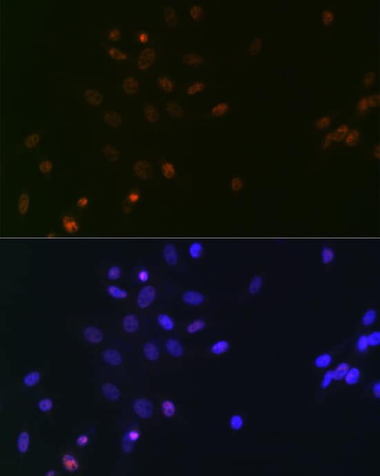 SUPT5H Antibody (9V9G7)