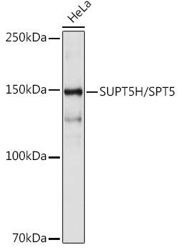 SUPT5H Antibody (9V9G7)